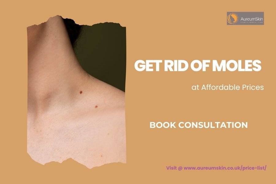 mole removal price