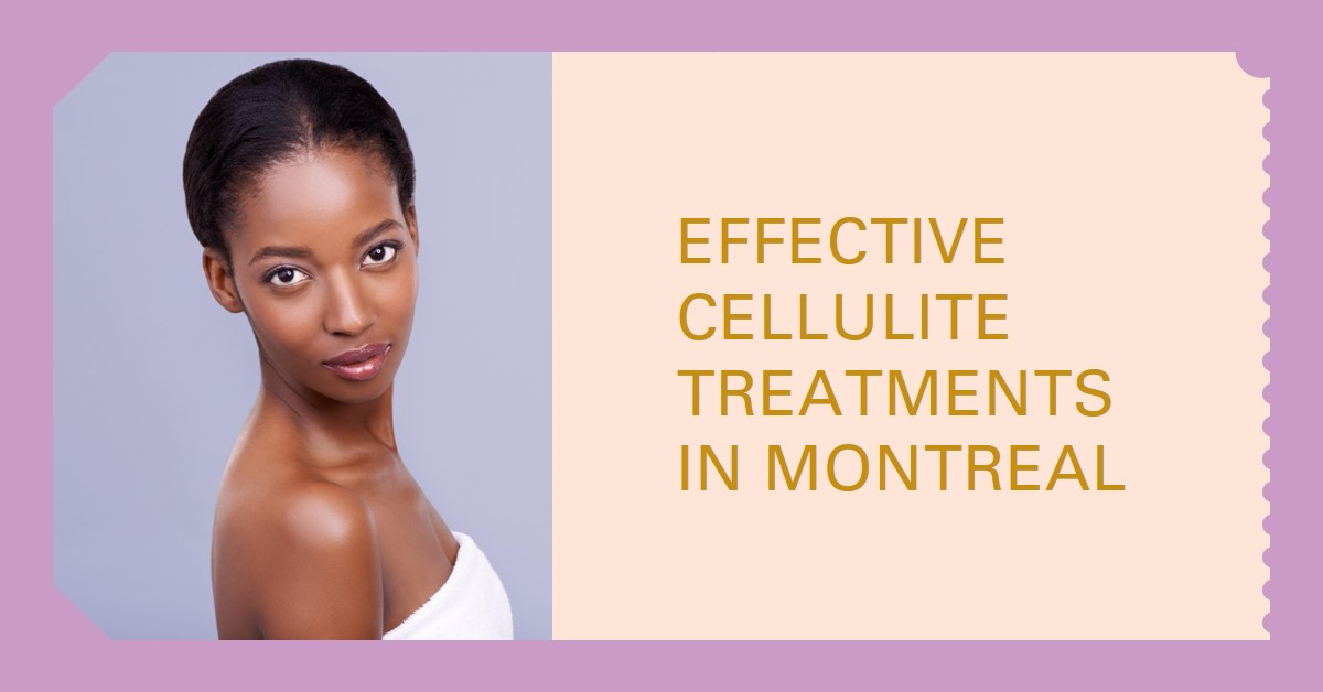 Cellulite Treatments in Montreal